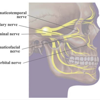 Trigeminal branches